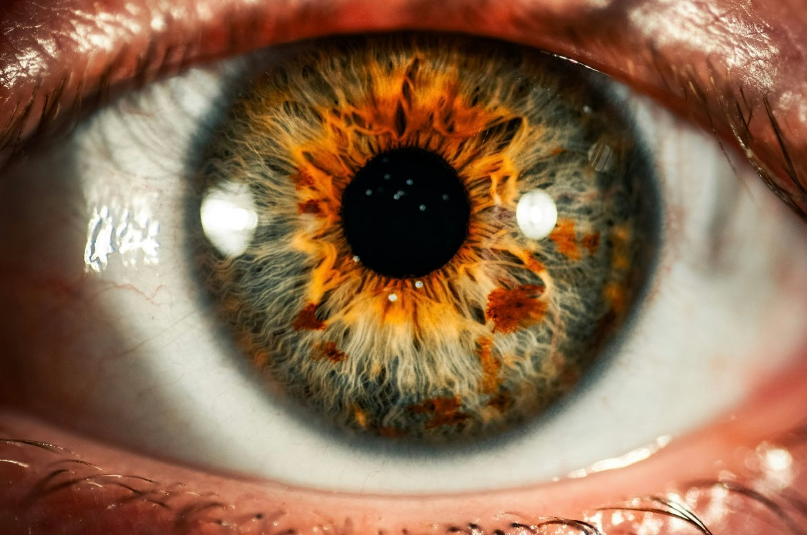 FOLLOW-UP Consultation: Iridology, Nutrition, Dietary & Lifestyle