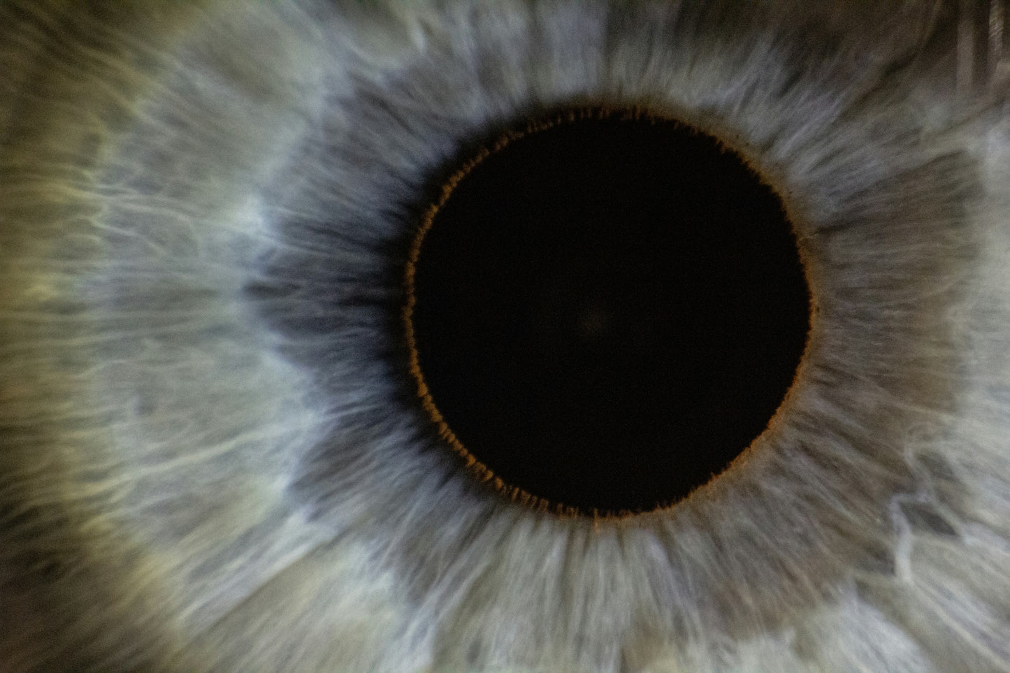 Iridology Consultation & Tailored Nutrition & Wellness Plan