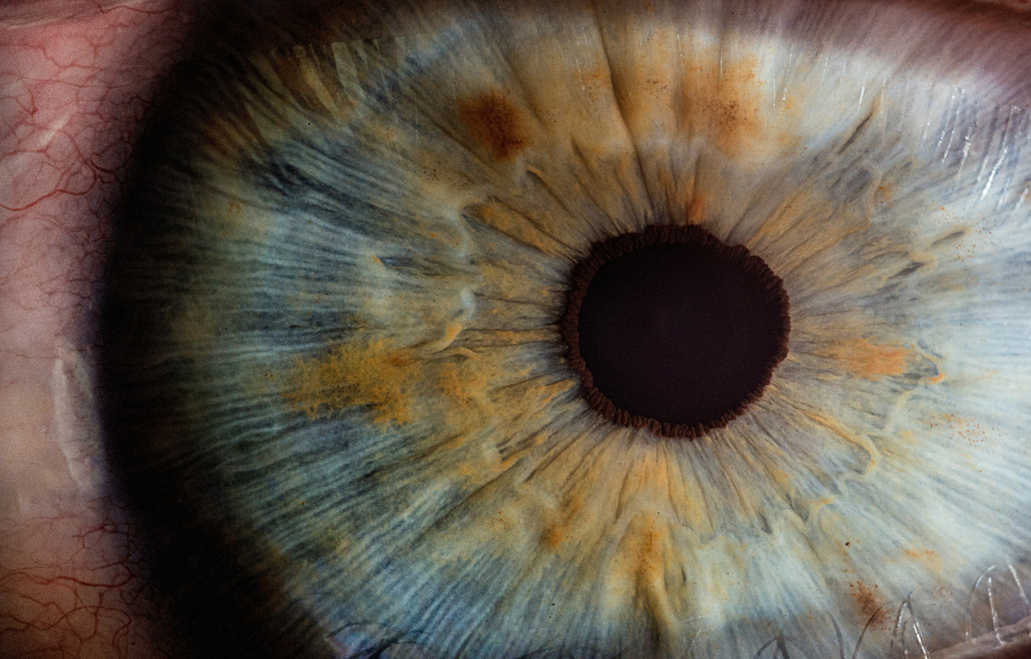 Iridology Consultation & Tailored Nutrition & Wellness Plan