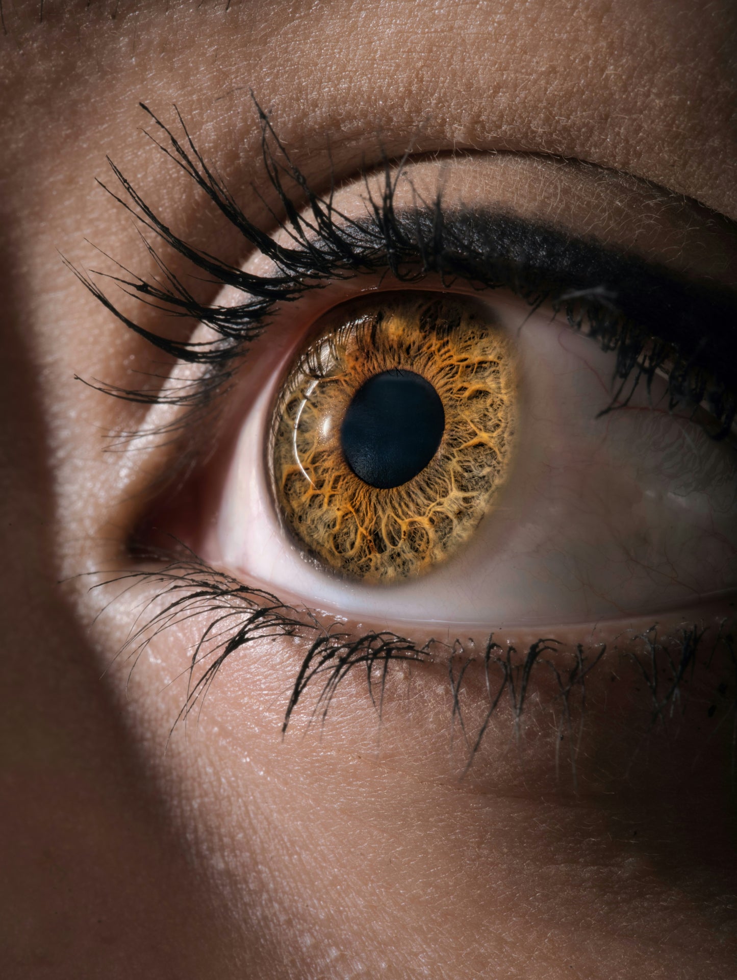 FOLLOW-UP Consultation: Iridology, Nutrition, Dietary & Lifestyle