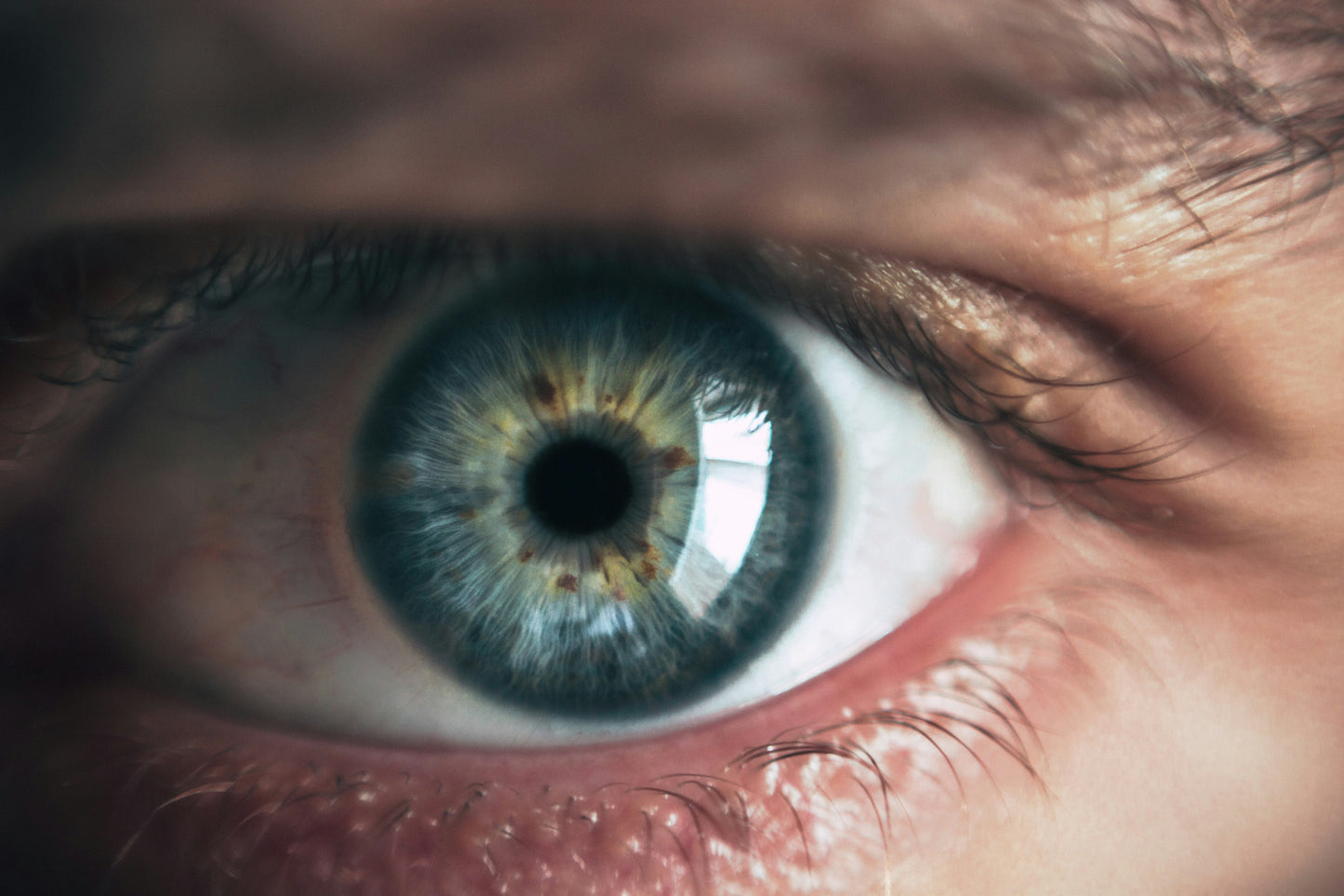 Iridology Consultation & Tailored Nutrition & Wellness Plan